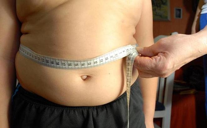 RN ocupa 2º lugar no ranking nacional de obesidade adulta