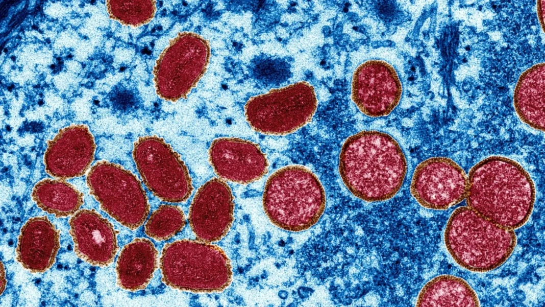 RN registra os dois casos de monkeypox em 2026 em Natal e São Gonçalo